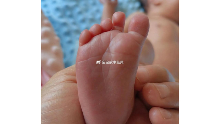 宝宝腿上有3个表现，也是“高个”特征，偷乐吧